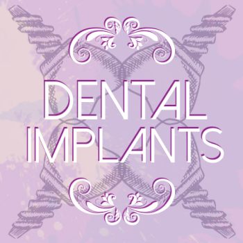 Dr. Williamson of Mark J. Williamson DDS in San Antonio discusses the benefits of dental implants for replacing missing teeth and stabilizing dentures.