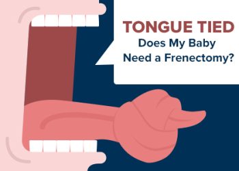 San Antonio dentist, Mark J. Williamson DDS, discusses different types of frenums, how they can cause problems for your baby’s mouth, and treatment with frenectomy.