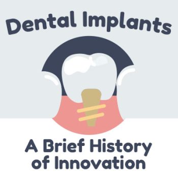 San Antonio dentist, Dr. Williamsom at Mark J. Williamson, DDS, discusses dental implants and shares some information about their history.