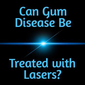 San Antonio dentist, Dr. Williamson at Mark J. Williamson DDS tells patients about LANAP®, a revolutionary way to treat gum disease!