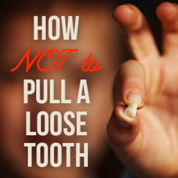 San Antonio dentist, Mark J. Williamson DDS, tells parents the do’s and don’ts of pulling your child’s loose baby teeth for the safest and most painless experience.