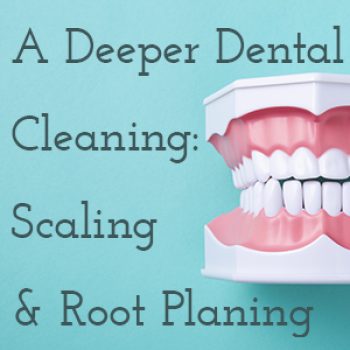 San Antonio dentist, Dr. Williamsom at Mark J. Williamson, DDS, tells patients about what scaling and root planing is and why it might be part of their treatment plan.