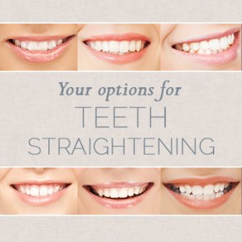 San Antonio dentist, Dr. Williamsom at Mark J. Williamson, DDS, shares all you need to know about choosing the right teeth straightening option for you.