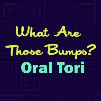 San Antonio dentist, Dr. Williamsom at Mark J. Williamson, DDS, explains oral tori: what they are, why they happen, and whether they are a cause for concern.