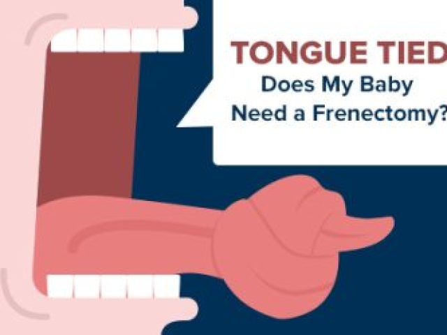 Tongue Tied: Does My Baby Need a Frenectomy? (featured image)