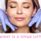 The Sinus Lift: A Guide to Understanding the Procedure (featured image)