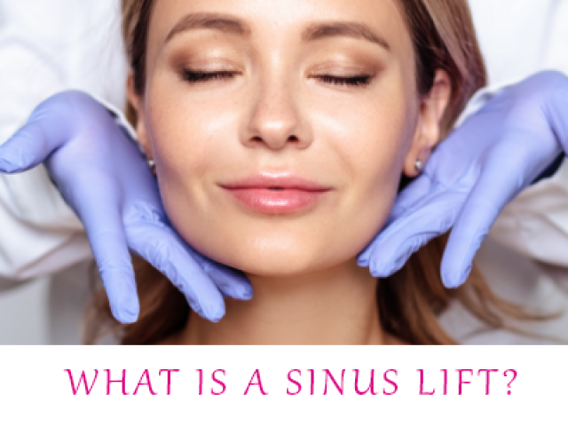 The Sinus Lift: A Guide to Understanding the Procedure (featured image)